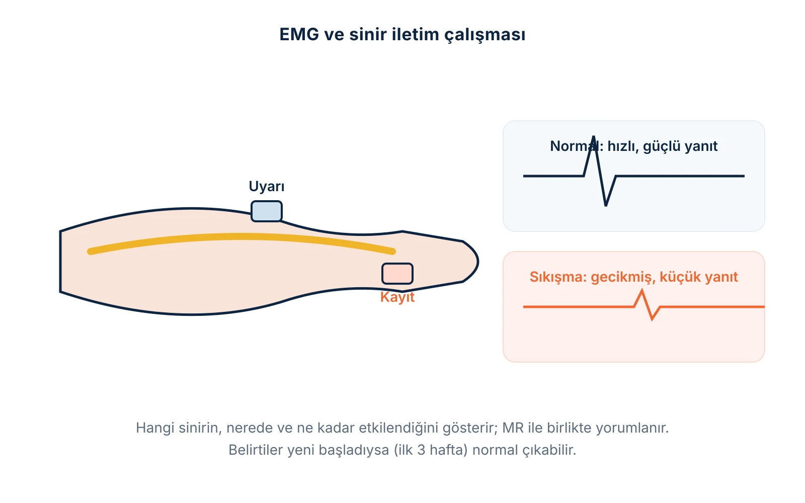 EMG ve sinir iletim çalışması: sinirin uyarılıp kastaki yanıtın ölçülmesi